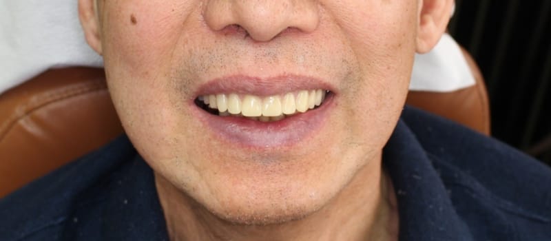 denturepost denturepost