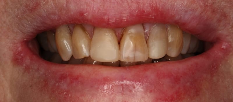 fillingpost fillingpost