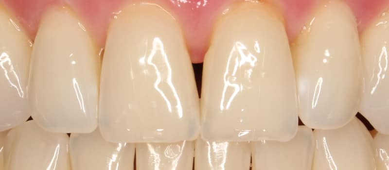 img_5705_dxo Cosmetic Dentistry