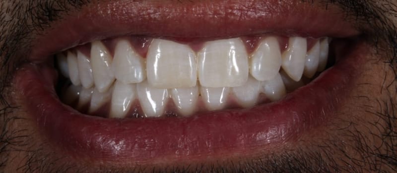 whiteningpost whiteningpost